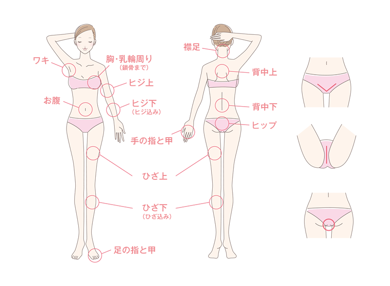 脱毛箇所説明図